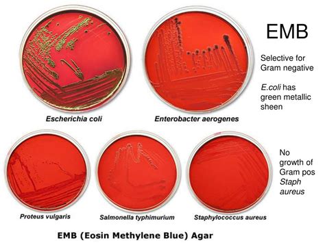 emb agar selective or differential